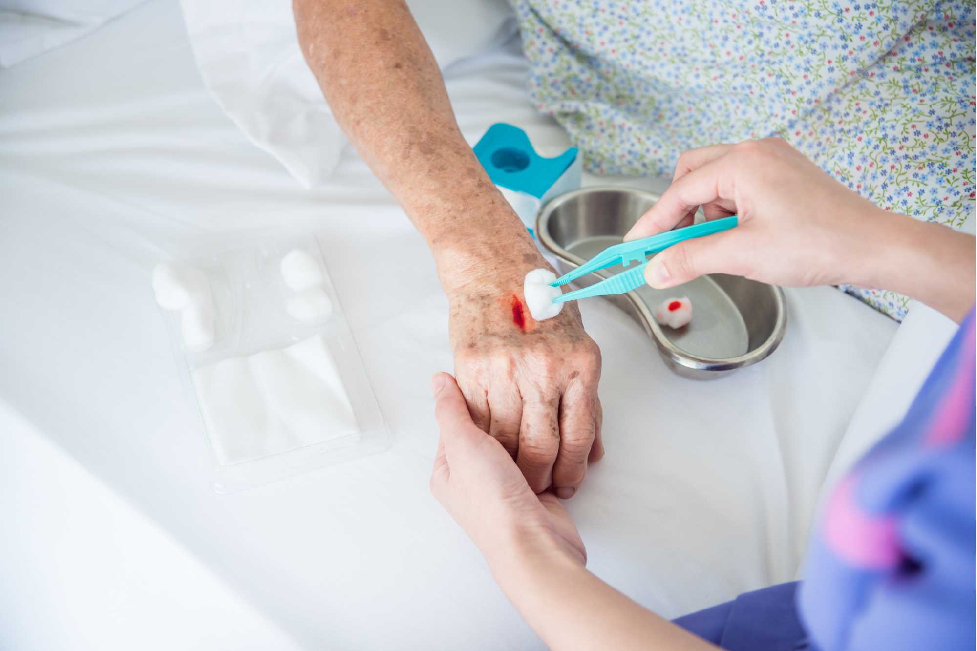 Vyčistenie otvorenej rany